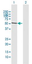 Anti-ATG16L1 Rabbit Polyclonal Antibody