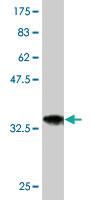 Anti-NEU2 Mouse Monoclonal Antibody [clone: 2E5]