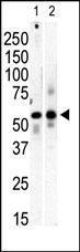 Anti-PI 4 Kinase Type 2 beta Rabbit Polyclonal Antibody (FITC (Fluorescein))