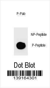 Anti-PARP1 Rabbit Polyclonal Antibody (Biotin)