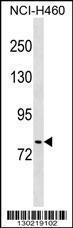 Anti-KRIT1 Rabbit Polyclonal Antibody