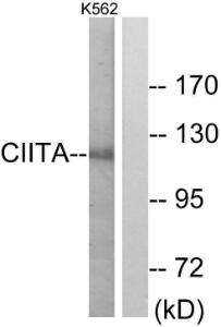 Western blot analysis of lysates from K562 cells using Anti-CIITA Antibody. The right hand lane represents a negative control, where the Antibody is blocked by the immunising peptide