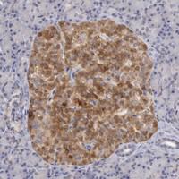 Anti-TMED8 Rabbit Polyclonal Antibody