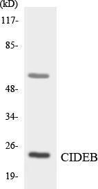 Anti-CIDEB antibody