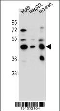 Anti-LRRC28 Rabbit Polyclonal Antibody