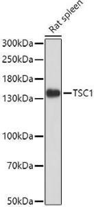 Western blot analysis of extracts of Rat spleen, using Anti-Hamartin Antibody (A12695) at 1:1000 dilution