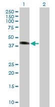 Anti-SGK2 Mouse Polyclonal Antibody