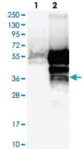 Anti-TMED8 Rabbit Polyclonal Antibody