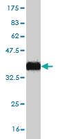 Anti-ZNF124 Mouse Monoclonal Antibody [clone: 4G4]