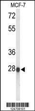 Anti-ABHD11 Rabbit Polyclonal Antibody (AP (Alkaline Phosphatase))