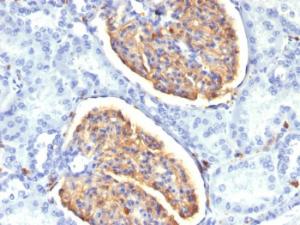 Immunohistochemical analysis of formalin-fixed, paraffin-embedded human kidney using Anti-Iba1 Antibody [AIF1/1909]