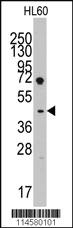 Anti-FCGR2A Rabbit Polyclonal Antibody