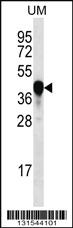 Anti-PROX2 Rabbit Polyclonal Antibody