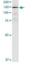 Anti-PDGFRA Polyclonal Antibody Pair