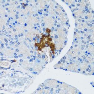 Immunohistochemistry analysis of paraffin-embedded rat pancreatic islet using Anti-Hamartin Antibody (A12695) at a dilution of 1:200 (40x lens). Perform microwave antigen retrieval with 10 mM PBS buffer pH 7.2 before commencing with IHC staining protocol