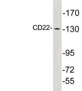 Western blot analysis of lysates from K562 cells using Anti-CD22 Antibody