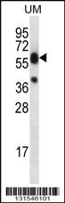 Anti-LIPM Rabbit Polyclonal Antibody