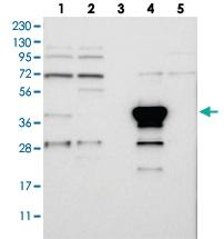 Anti-PIGG Rabbit Polyclonal Antibody