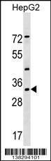 Anti-LZTFL1 Rabbit Polyclonal Antibody (AP (Alkaline Phosphatase))