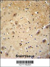 Anti-DCAF13 Rabbit Polyclonal Antibody (HRP (Horseradish Peroxidase))