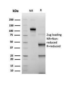 SDS-PAGE analysis of Anti-ERG Antibody [rERG/6843] under non-reduced and reduced conditions; showing intact IgG and intact heavy and light chains, respectively. SDS-PAGE analysis confirms the integrity and purity of the antibody.