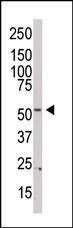 Anti-PI 4 Kinase Type 2 beta Rabbit Polyclonal Antibody (AP (Alkaline Phosphatase))