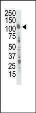 Anti-Insulin Receptor R Rabbit Polyclonal Antibody (HRP (Horseradish Peroxidase))