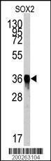 Anti-SOX2 Mouse Monoclonal Antibody [clone: 57CT23.3.4]