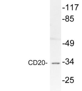 Western blot analysis of lysate from A549 cells using Anti-CD20 Antibody