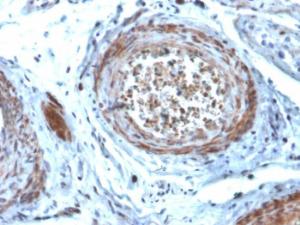 Immunohistochemical analysis of formalin-fixed, paraffin-embedded human testis using Anti-StAR Antibody [STAR/2077]