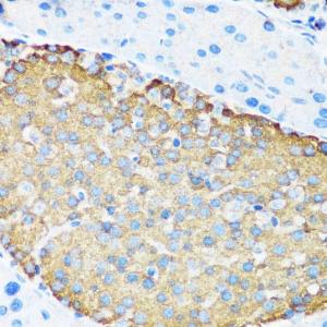 Immunohistochemistry analysis of paraffin-embedded mouse pancreatic islet using Anti-Hamartin Antibody (A12695) at a dilution of 1:200 (40x lens). Perform microwave antigen retrieval with 10 mM PBS buffer pH 7.2 before commencing with IHC staining protocol