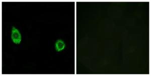 Antibody anti-CHST9 100 µg