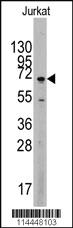 Anti-MAPK4 Rabbit Polyclonal Antibody