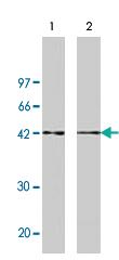 Anti-AGER Rabbit Polyclonal Antibody