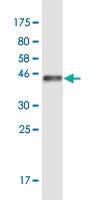 Anti-SCP2D1 Mouse Monoclonal Antibody [clone: 3C11]