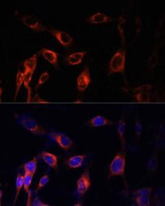 Immunofluorescence analysis of NIH-3T3 cells using Anti-Hamartin Antibody (A12695) at a dilution of 1:100 (40x lens). DAPI was used to stain the cell nuclei (blue)