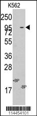 Anti-C18orf8 Rabbit Polyclonal Antibody