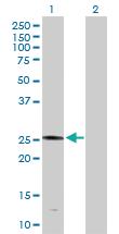 Anti-PLA2G4D Rabbit Polyclonal Antibody