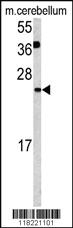 Anti-GLRX2 Rabbit Polyclonal Antibody