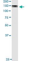 Anti-PDGFRB Antibody Pair