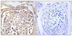 Antibody anti-CHST9 100 µg