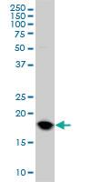 Anti-UBE2C Mouse Monoclonal Antibody [clone: 9D3]