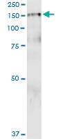 Anti-PDGFRB Polyclonal Antibody Pair