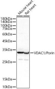 Western blot analysis of extracts of various cell lines, using Anti-VDAC1/Porin Antibody (A12700) at 1:400 dilution