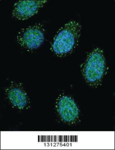 Anti-DTNA Rabbit Polyclonal Antibody