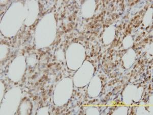 Anti-IRF9 Mouse Monoclonal Antibody [clone: 1D11]