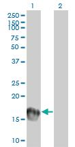 Anti-UBE2C Mouse Monoclonal Antibody [clone: 9D3]