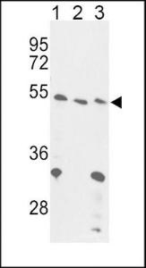 Anti-FOXP3 Rabbit Polyclonal Antibody (APC (Allophycocyanin))