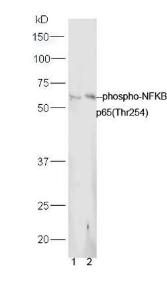 Anti-RELA Rabbit Polyclonal Antibody