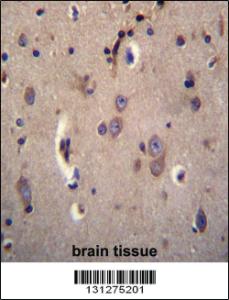 Anti-DTNA Rabbit Polyclonal Antibody